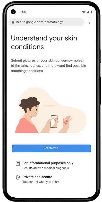 Image of a phone showing you each step of using the AI-powered dermatology assist tool.